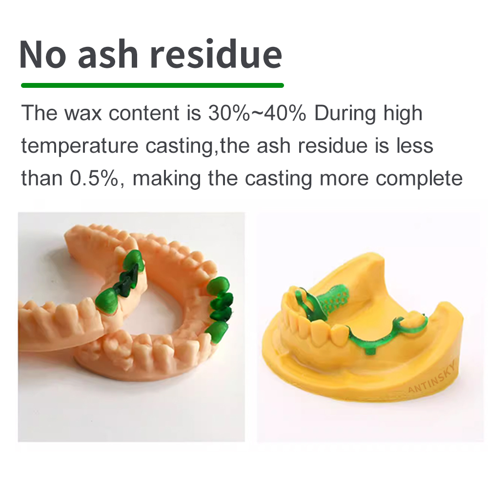 안틴스키 캐스터블 덴탈 스마트 레진 1kg 헤이기어스/ - 3D Printing Sla 리뷰 및 가격
